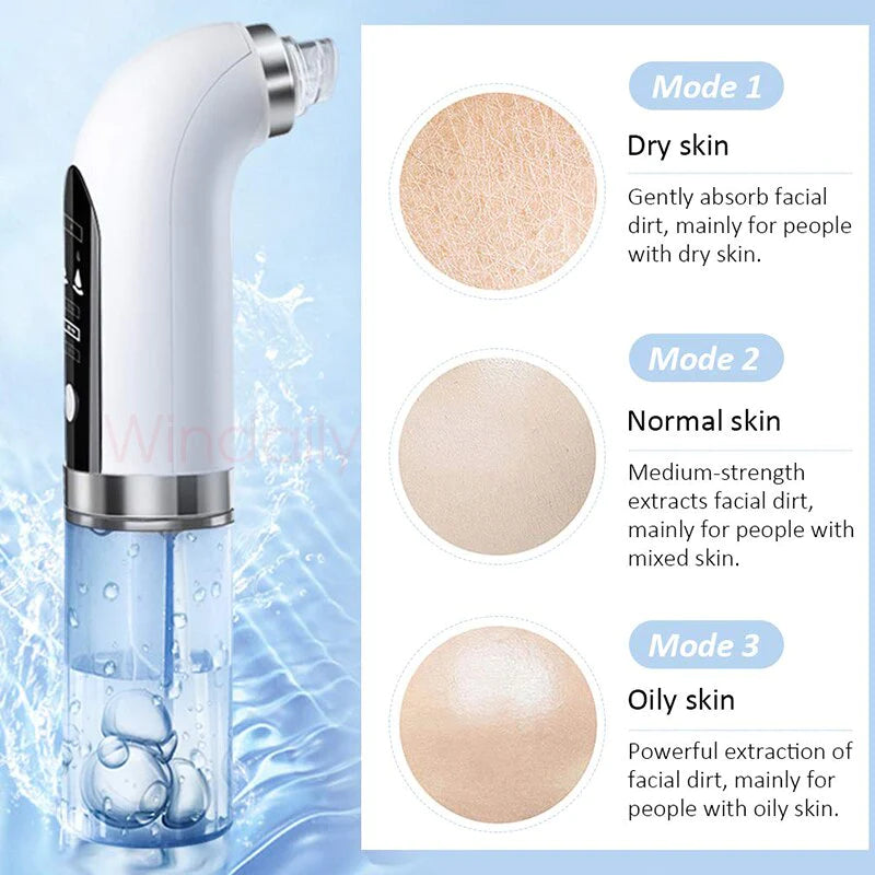 Claxten Blackhead Water Vacuum - Hot Sale 50%