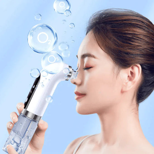 Claxten Blackhead Water Vacuum - Hot Sale 50%