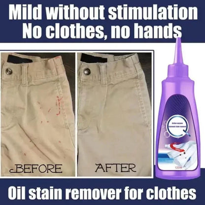 Active Enzyme Laundry Stain Remover - Hot Sale 50% Off