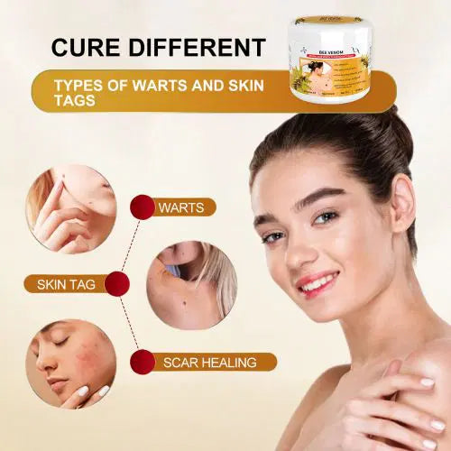 Bee Venom Mole and Wart Treatment Cream – Hot sale 50%