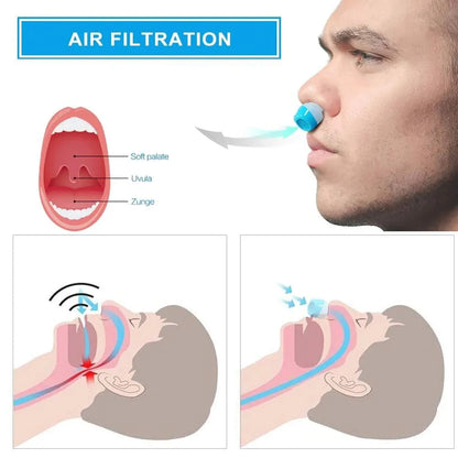 THE FIRST HOSELESS, MASKLESS, MICRO-CPAP ANTI SNORING