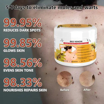 Bee Venom Mole and Wart Treatment Cream – Hot sale 50%