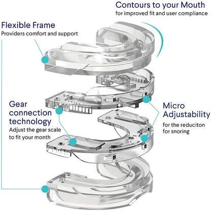 Z Comfort | Anti-snoring device | 2024 Hot Sales 70% OFF