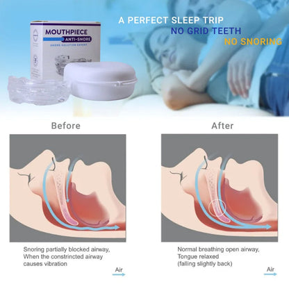 Z Comfort | Anti-snoring device | 2024 Hot Sales 70% OFF