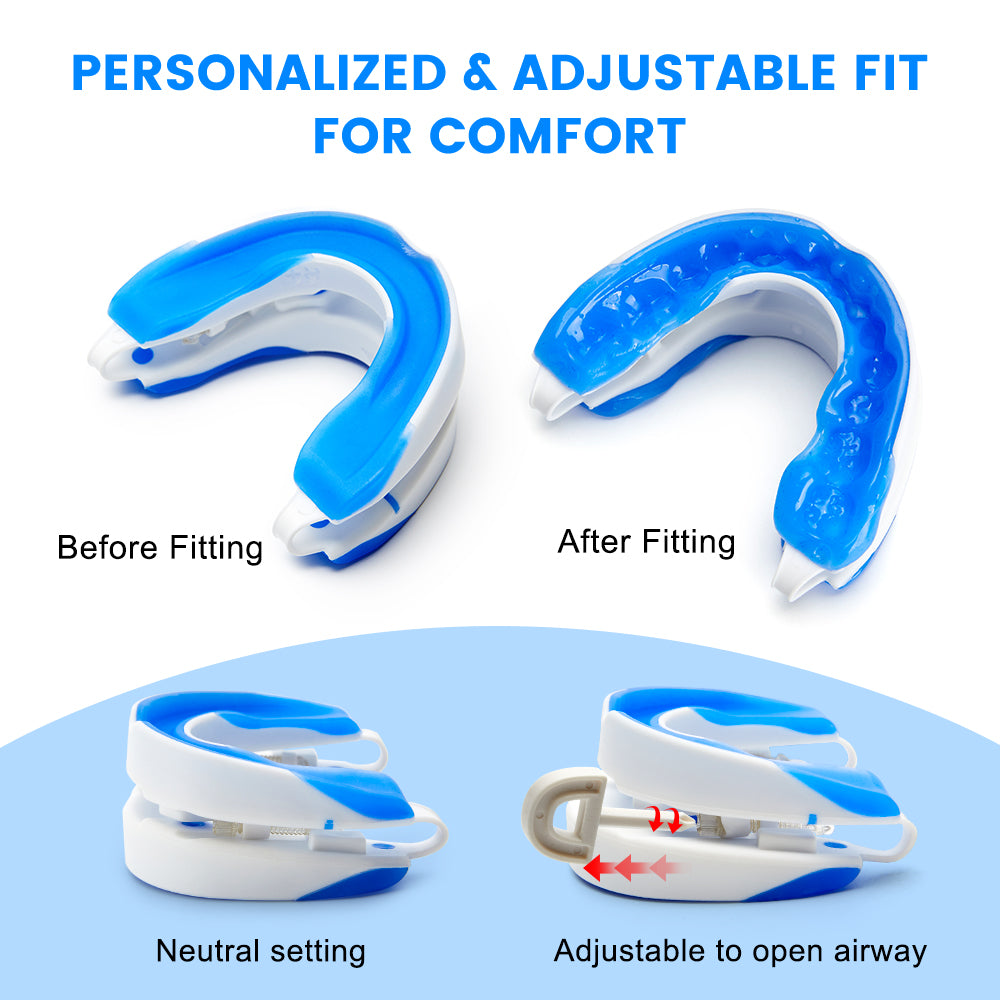 Adjustable Anti-Snoring Mouthpiece