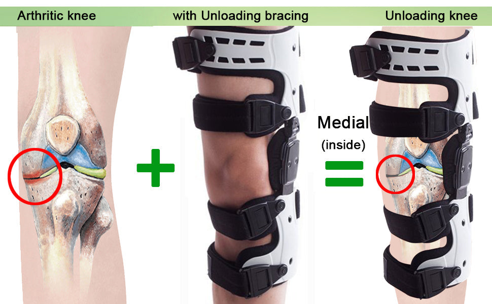 TrueAlign Knee Brace