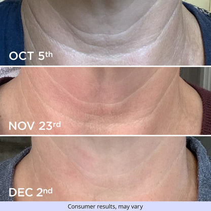 Tighten & Lift Neck Cream - Hot Sale 50%