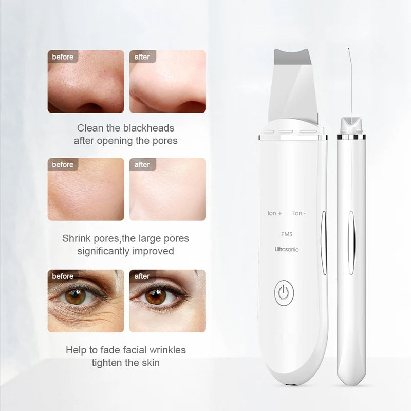 ULTRASONIC SKIN SCRUBBER DEEP FACE CLEANING MACHINE