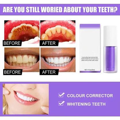 Teeth Colour Corrector Serum-LAST DAY 49% OFF