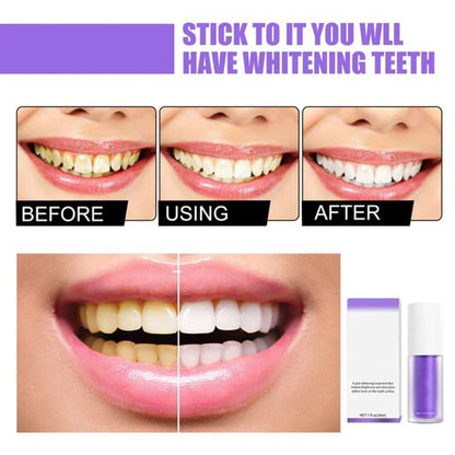 Teeth Colour Corrector Serum-LAST DAY 49% OFF