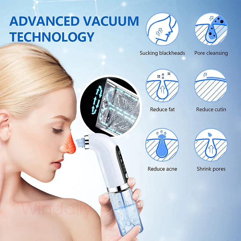 Claxten Blackhead Water Vacuum - Hot Sale 50%